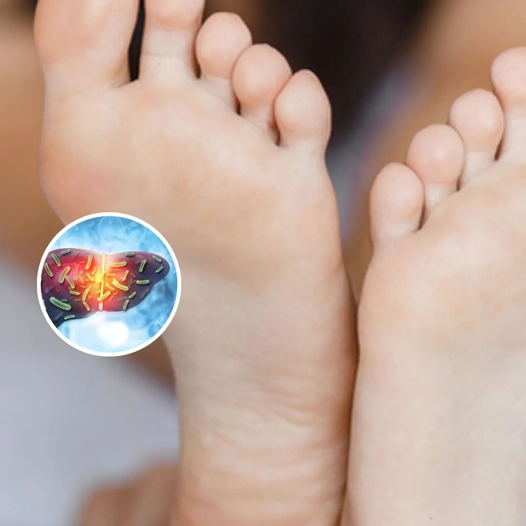 hese 4 Changes on the Soles of Your Feet May Signal Poor Liver Health — Not Having Them Is a Blessing