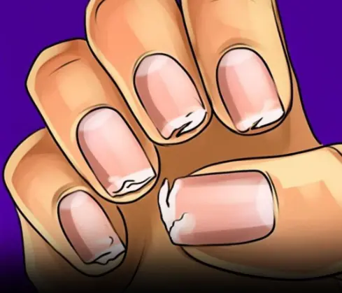 You Should Never Ignore These 9 Things Your Fingernails Reveal About Your Health