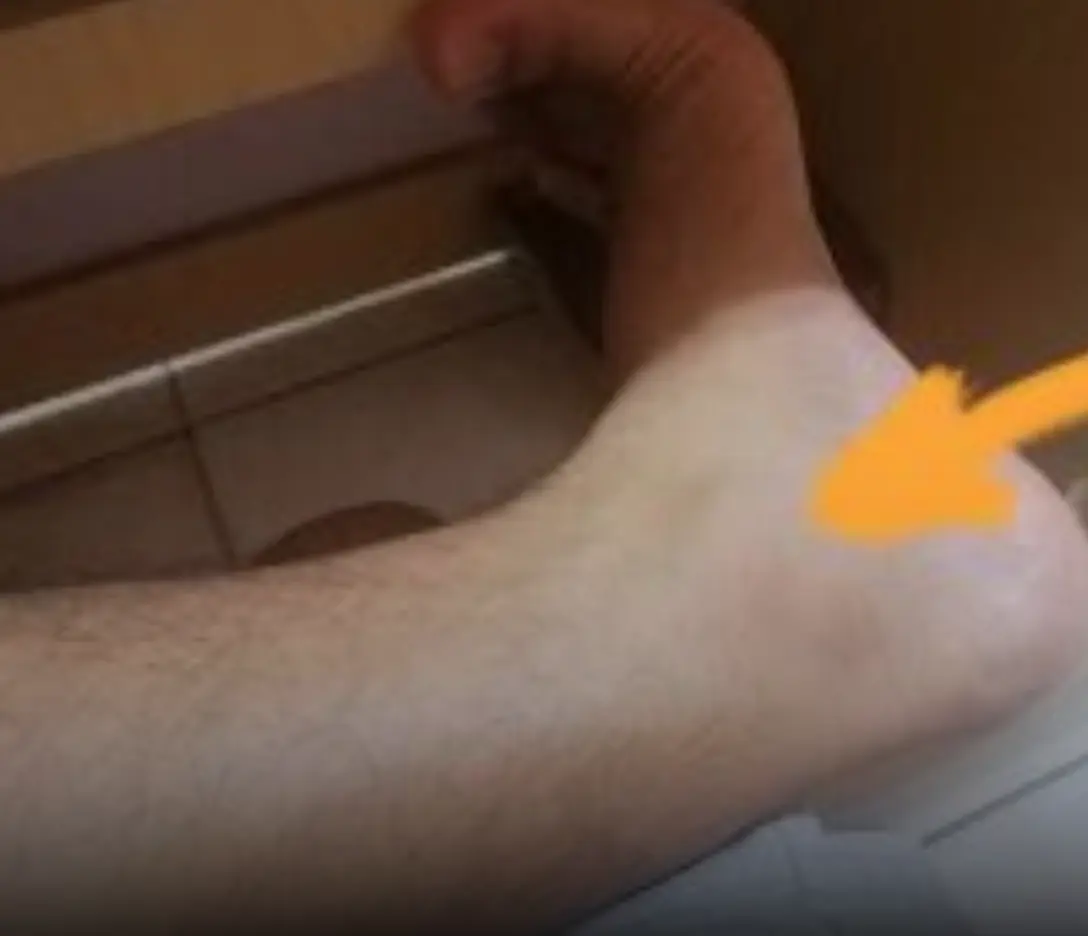 How your feet can reveal early signs of dia.betes