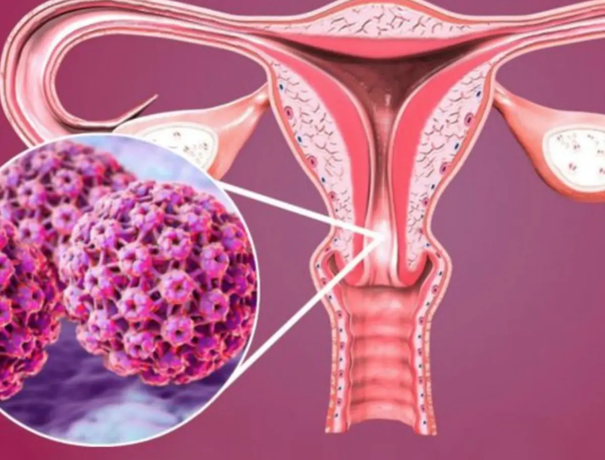 5 early warning signs of cervical can.cer