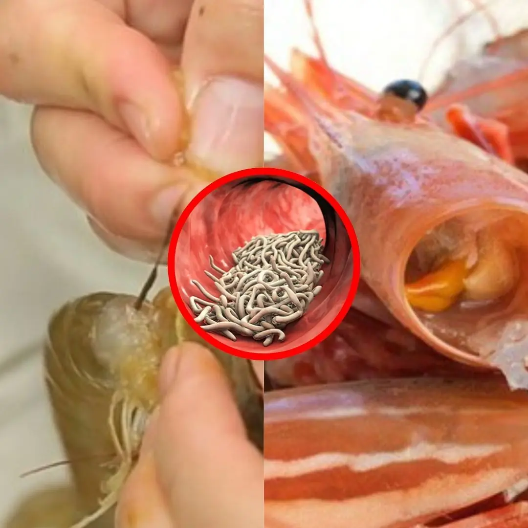 3 'extremely toxic' parts of shrimp are full of parasites, don't try to eat them or it will harm your health