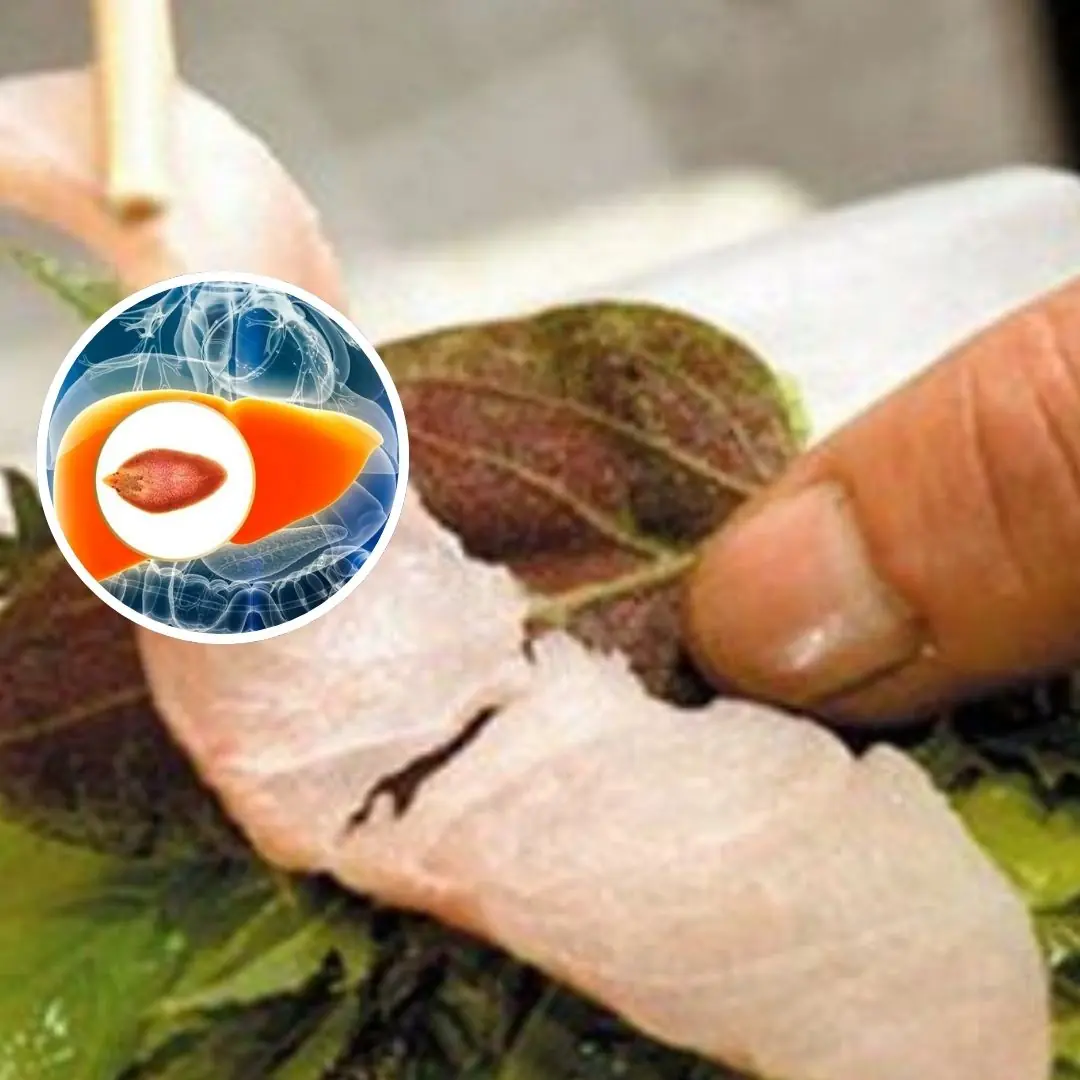 The ri.sk of liver fluke infection from eating habits that many people have