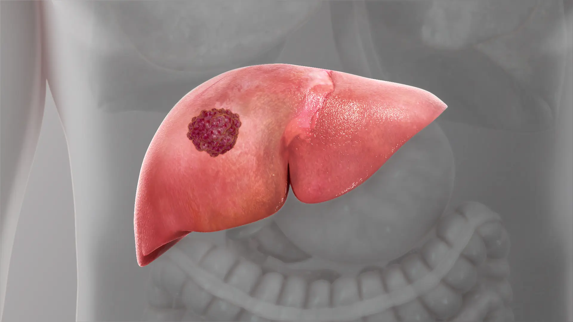 The 6 Earliest Symptoms of Liv.er Can.cer Most People Overlook