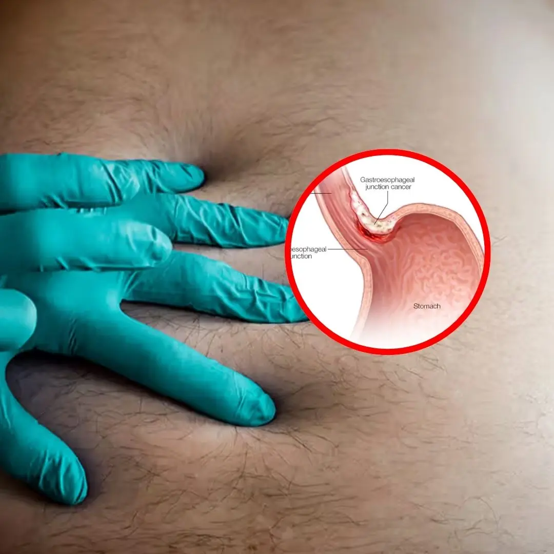 Most stomach can.cers are detected late: Doctors say there are 5 symptoms after meals