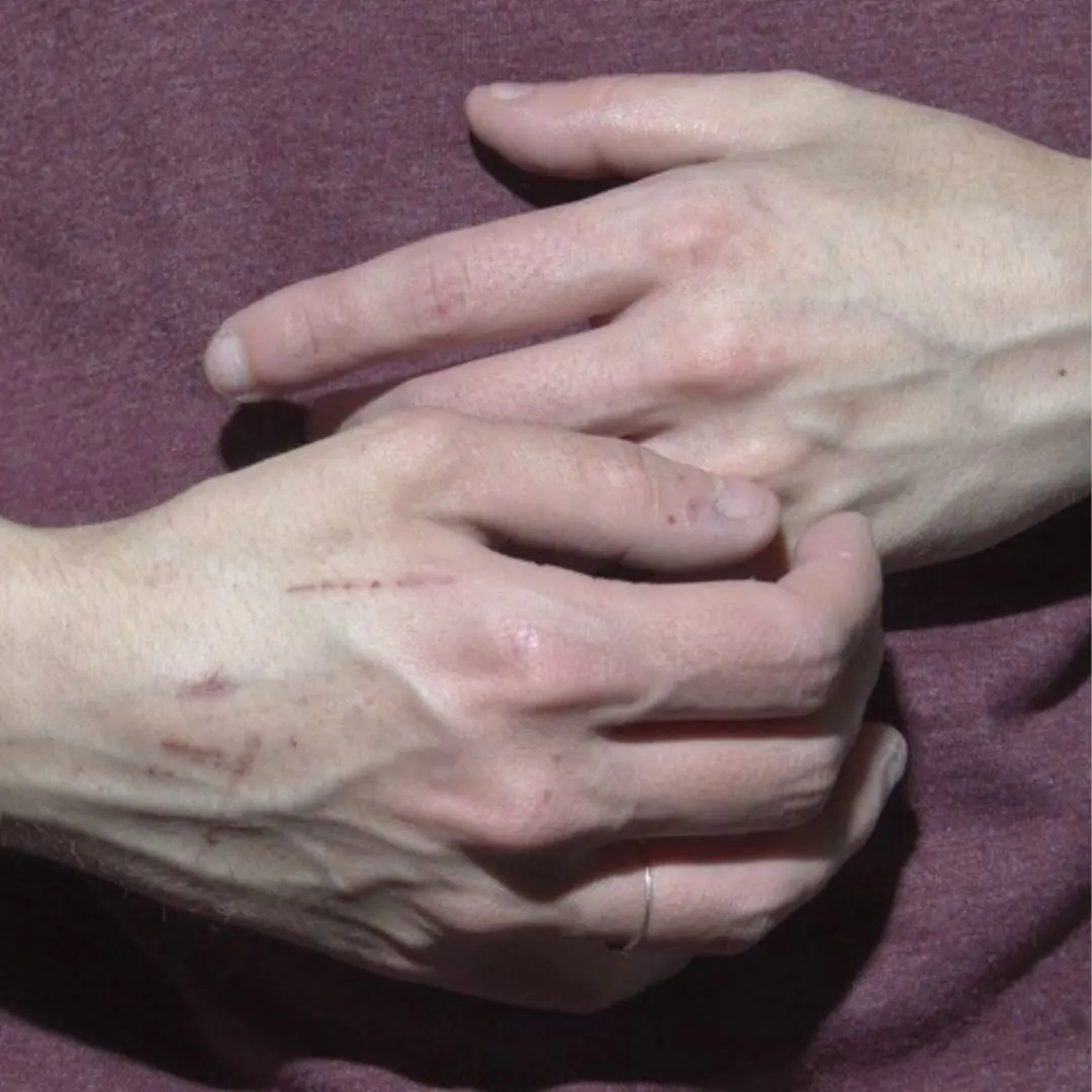 If you see someone with bulging veins, you must tell them these things...
