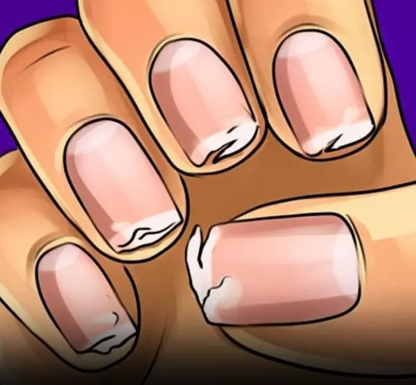 You should never ignore these 9 things your fingernails reveal about your health