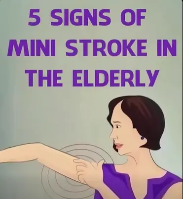 7 Signs of Mini Stroke in The Elderly