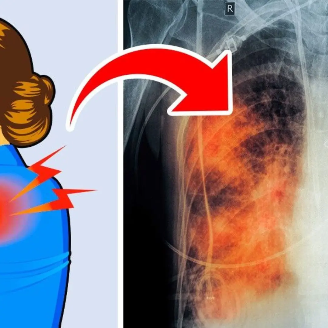 Pain in these 3 spots shouldn’t be ignored — it may signal lung can.cer