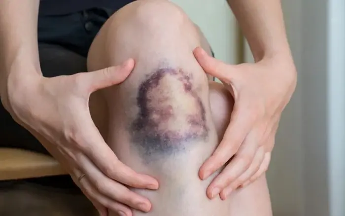 People with These 4 Skin Signs May Have “Loads” of Can.cer Cells Without Knowing It