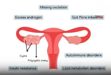 Eat 6 things to help women detoxify their ovaries and prevent gynecological diseases