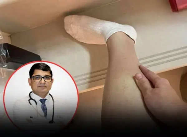 Beware of Diabetes If You Frequently Experience These 5 Strange Symptoms