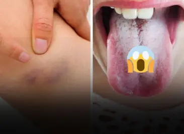 11 Signs Your Body Is Giving You Important Alerts