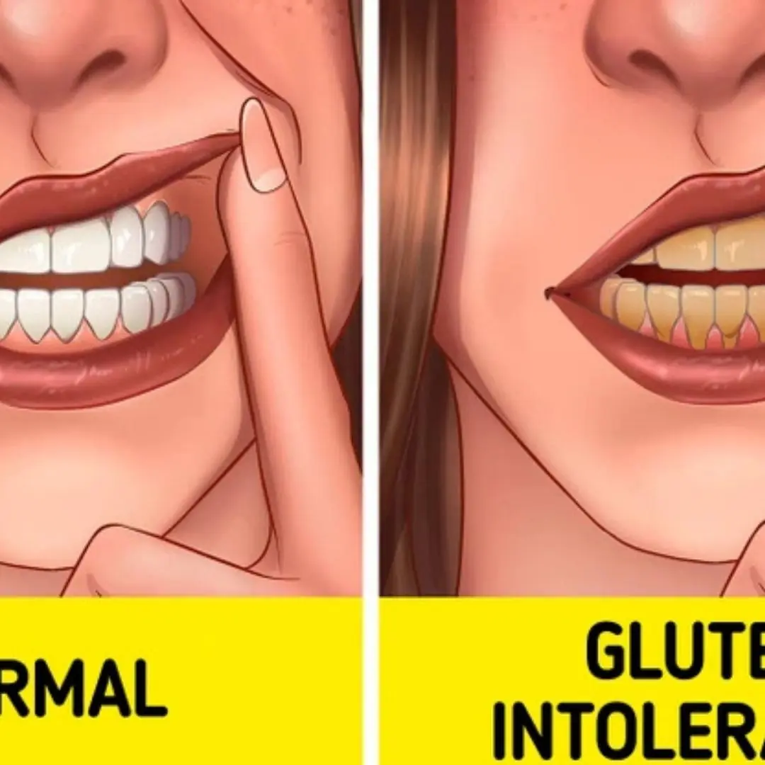 11 Sneaky Signs You Might Actually Be Gluten Intolerant