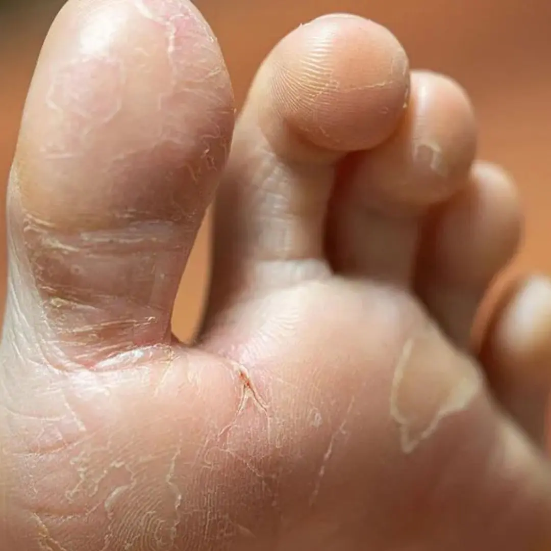 Médico alerta para 7 sintomas normais que você nunca deve ignorar