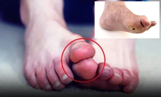 Mute Here are five unusual foot symptoms