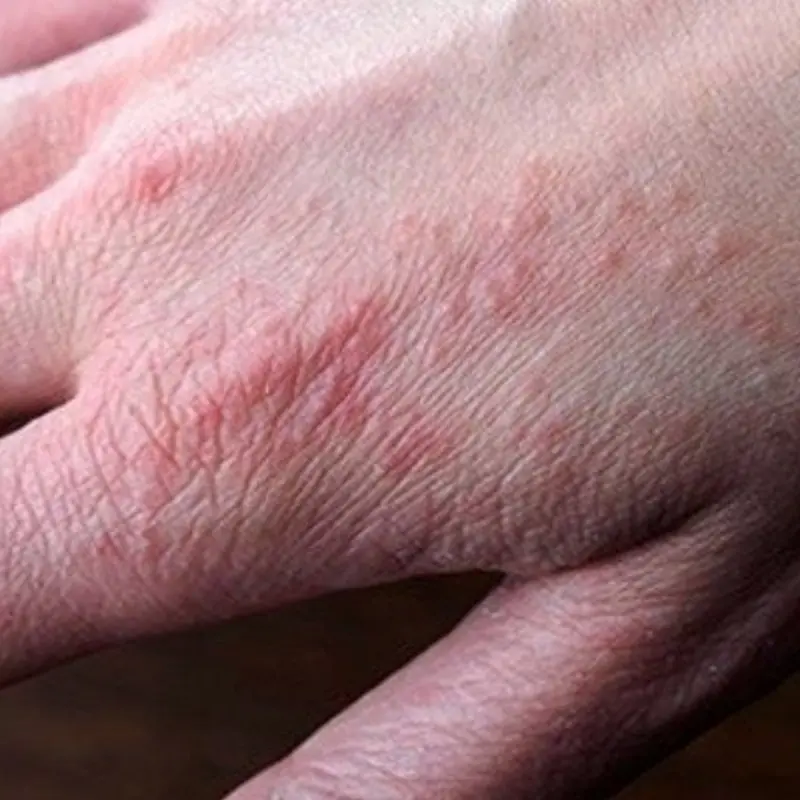 Doctors warn: if you have these tiny red dots on your arm or hand, do not ignore the warning signs