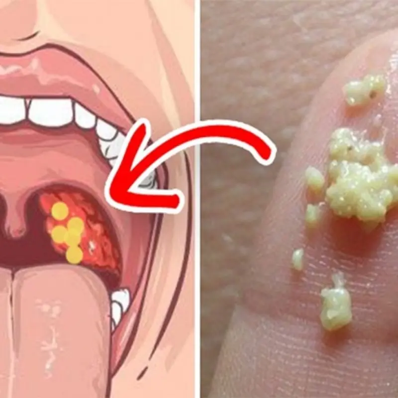 After Sneezing Several Times, I Noticed Something Strange in My Throat