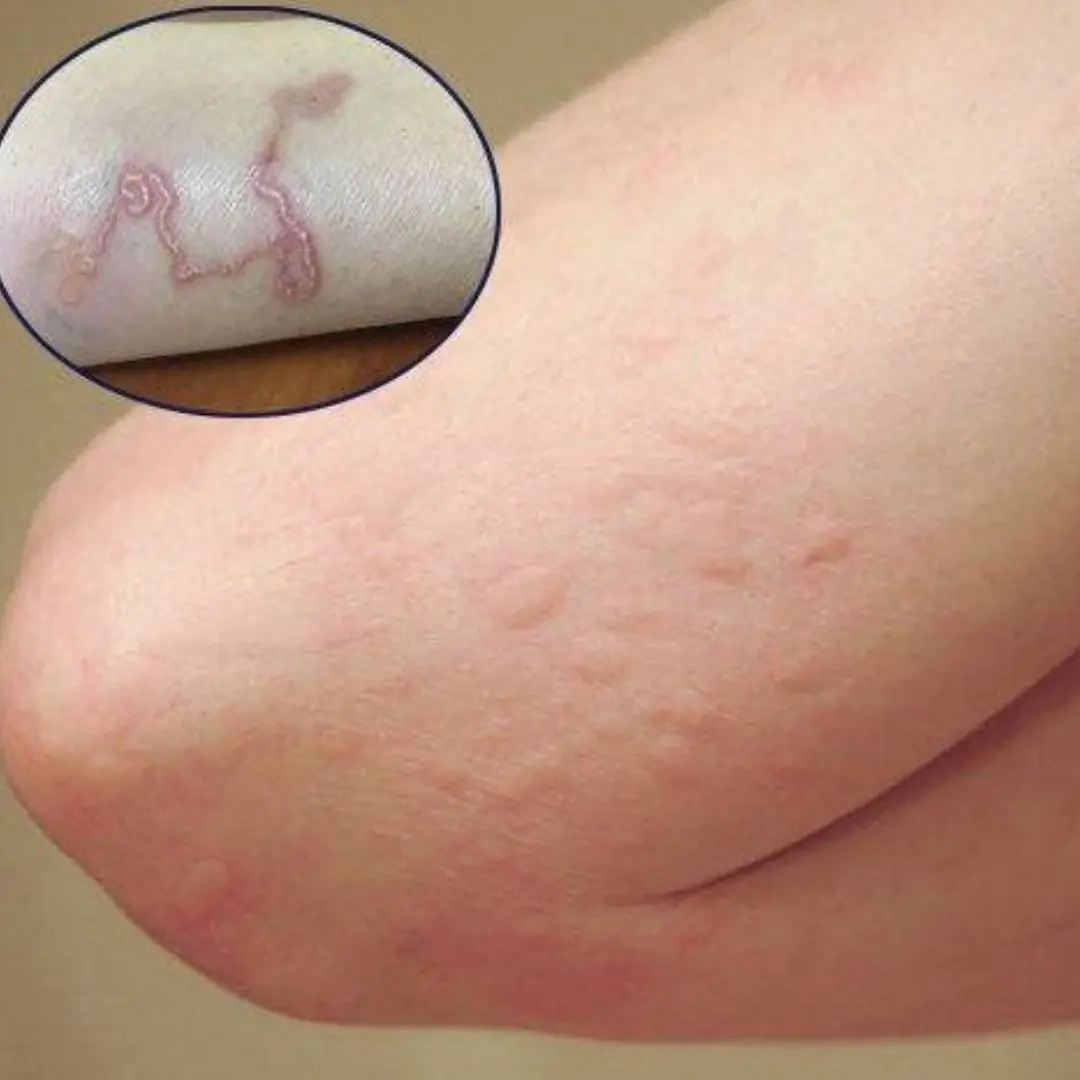 6 Signs You Have a Dog Tapeworm Infection That You Can Easily Ignore