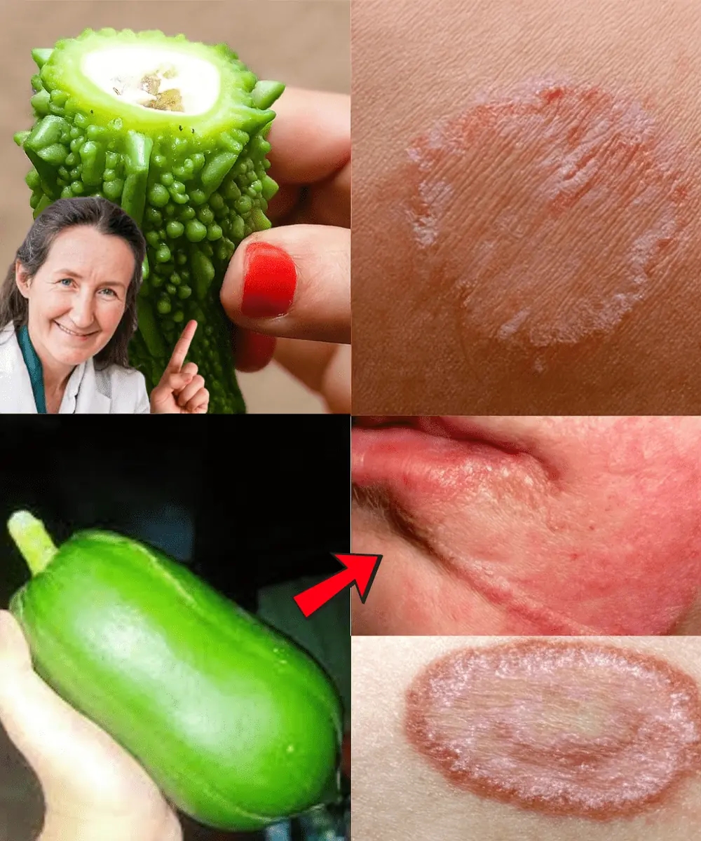 9 Natural Remedies That Wipe Out Fungal Infections Fast — No Chemicals, Just Results
