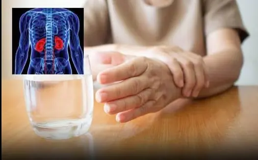 People with liver failure often have 3 characteristics on their hands, if you have 1 you should see a doctor soon