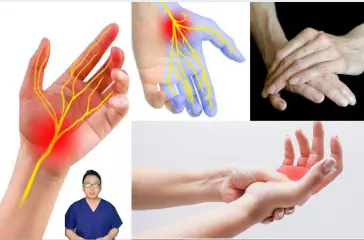 4 Early Warning Signs of a Stroke That Occur 15 Minutes Before It Happens