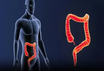 5 Signs of Appendicitis You Should Not Ignore