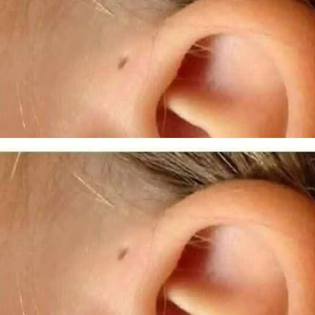 Do you know anyone with this mark on their ear? See what it means