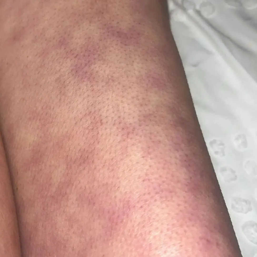 What those strange skin patterns might really mean