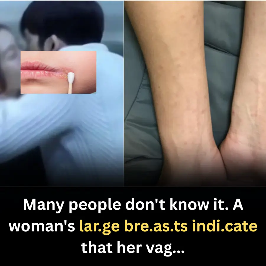 Skin Signs in Men That May In.dicate S.e.xu.ally Tran.smitted Dise.ases