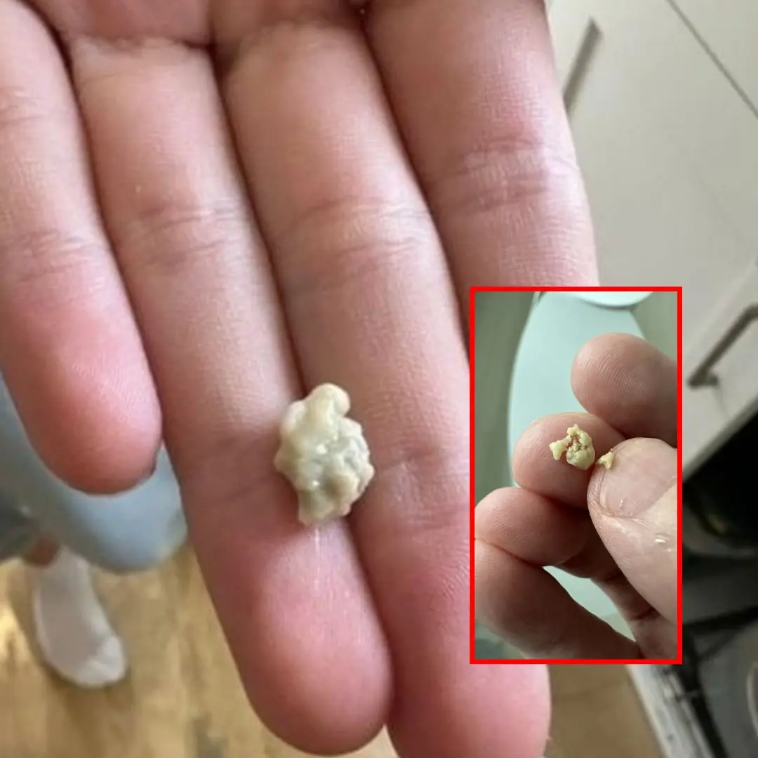 I sneezed 4-5 times yesterday and then felt something tickling my throat