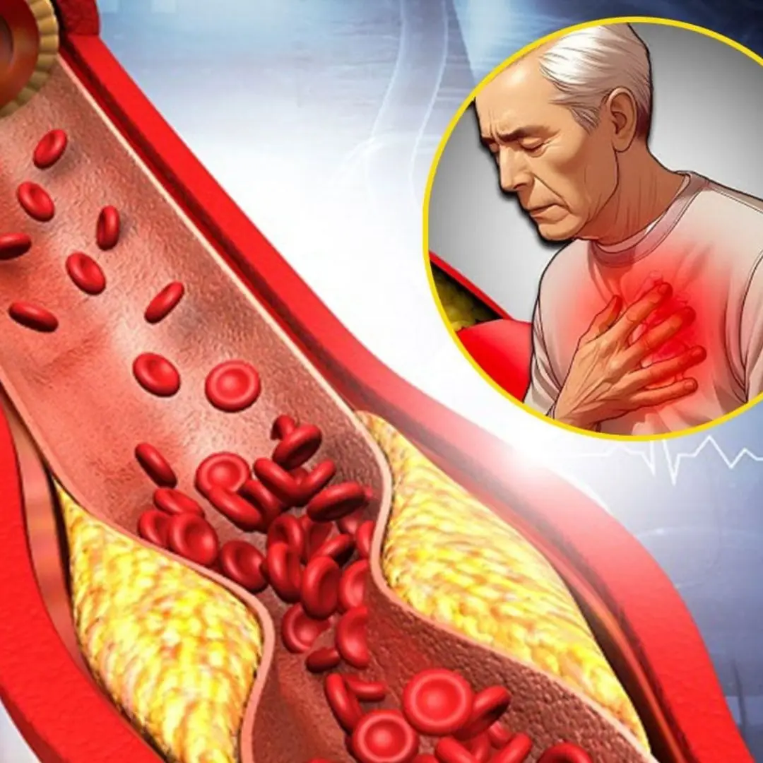 10 signs you’re living with clogged arteries