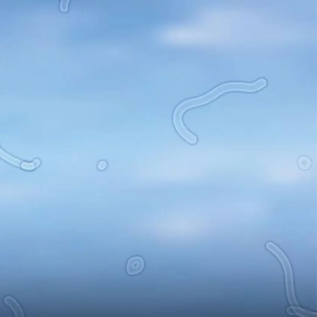 What Are Eye Floaters? Here What To Do If you Start Seeing Them, According to an Eye Doctor