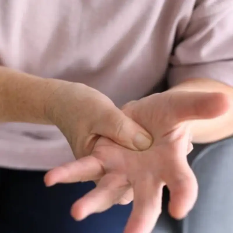 Doctors warn: three distinct hand signs may indicate li.ver failure. If you notice any of them, don’t delay seeing a doctor.