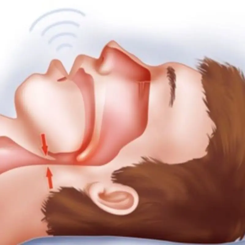 Frequent Drooling During Sleep? It Could Be a Sign of These Six Health Issues