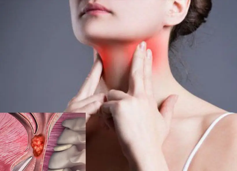 Warning: If You Notice This Sign in Your Body, Go to the Hospital Immediately or It May Be Late-Stage Nasoph.aryngeal Can.cer