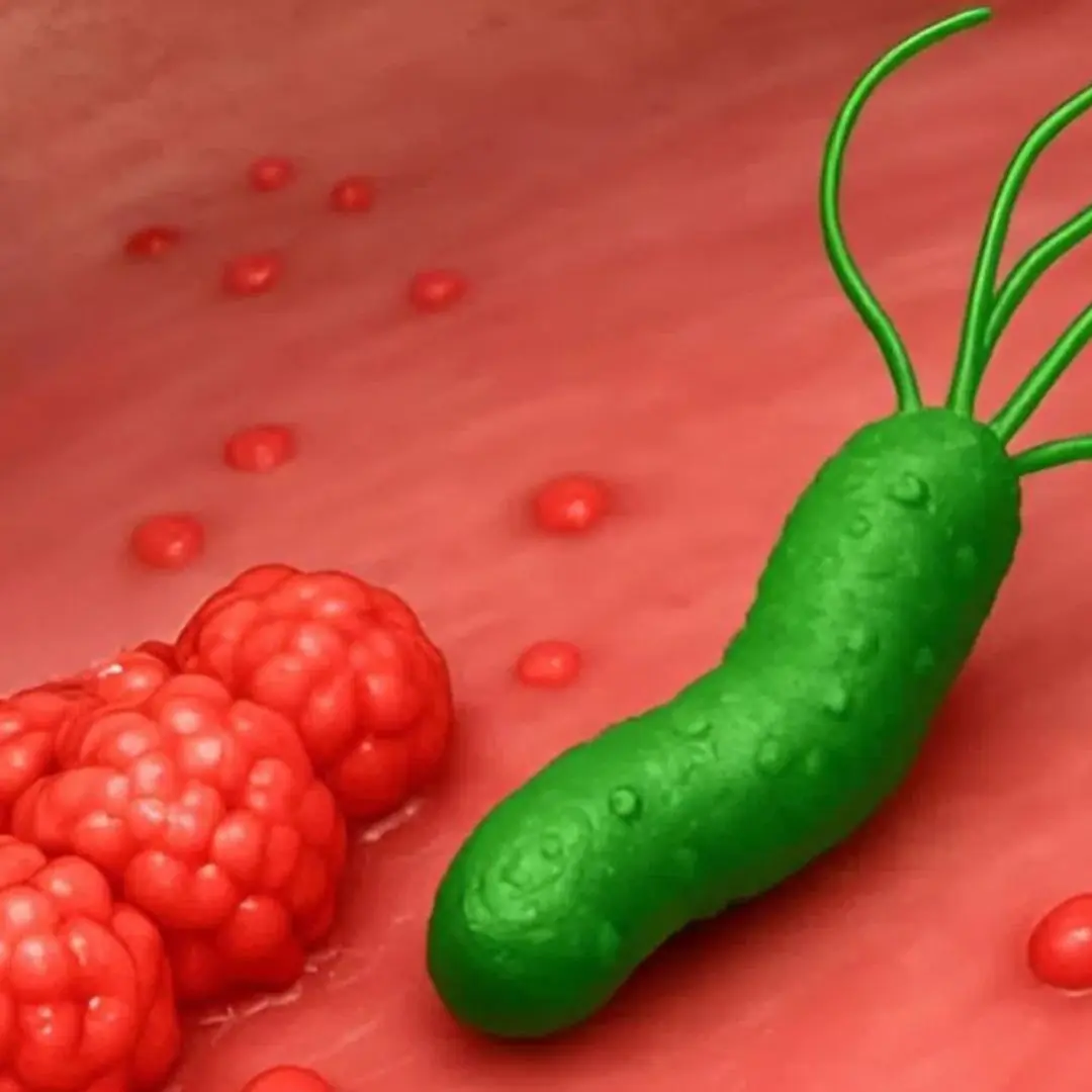 How to ki:ll the bacteria that causes bloating and heartburn