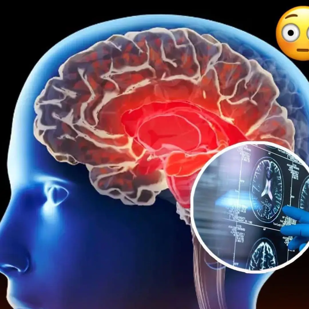 4 Red Flags Your Brain Might Be in Trouble as Experts Warn Alzheimer’s Can Start Decades Before Symptoms Appear