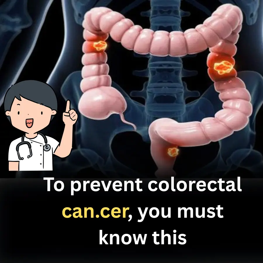 To prevent colorectal can.cer, you must know this