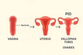 12 Silent Signs Your U.terus Is Begging for Help