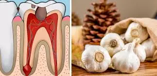 The Forgotten Home Remedy That Instantly Soothes Toothache