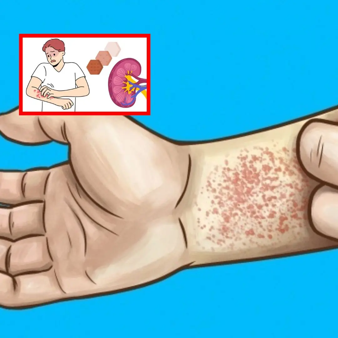 10 signs that you have kidney disease without knowing it