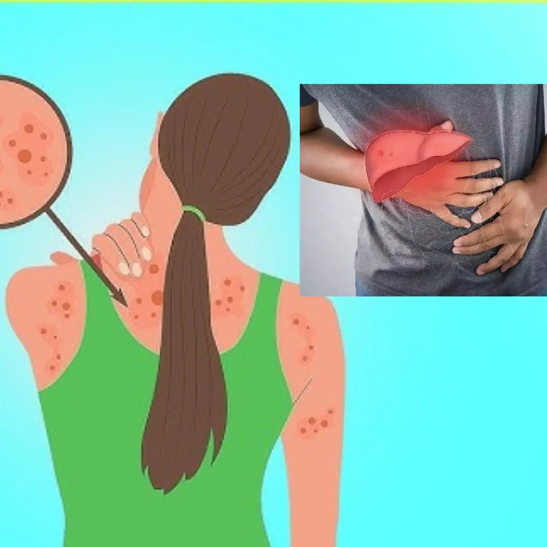 4 Evening Symptoms That May Signal Liver Failure