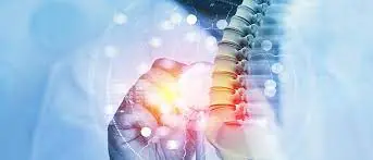 Osteoporosis—often called a “silent kil.ler” that requires serious attention.