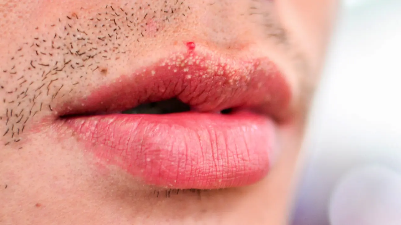 What causes unusual white spots or bumps to appear on the lips?