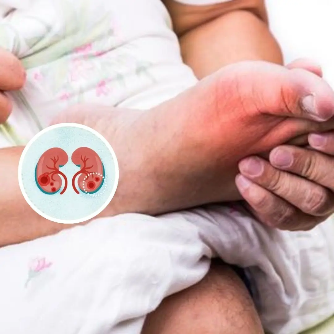 5 unusual signs in your feet that might be your kidneys crying for help