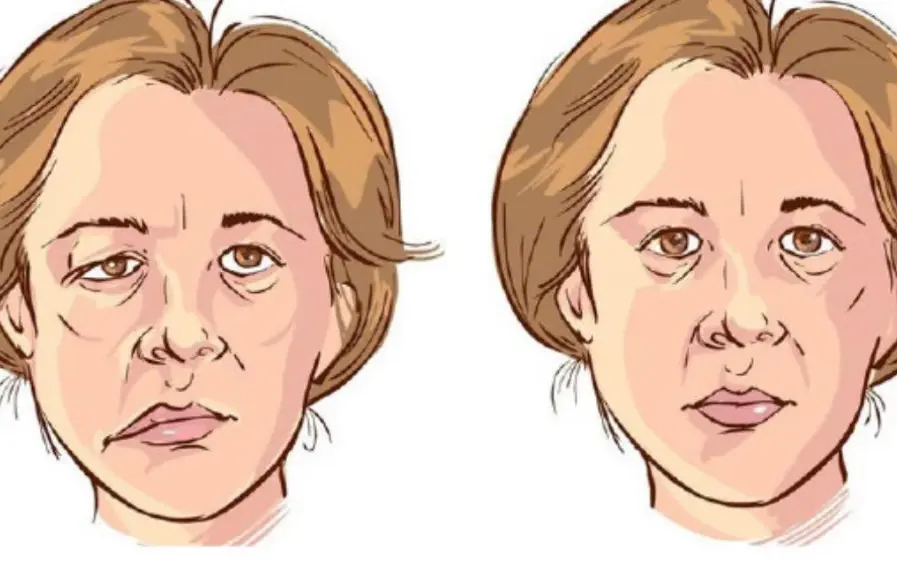 Early Warning Signs of a Str.oke That May Appear 90 Days in Advance