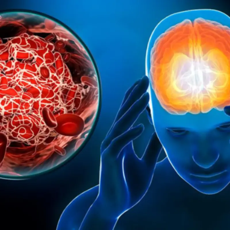 Can Onions Really Help Lower Uric Acid? Warning: These 3 Foods May Trigger a Sudden Str.oke