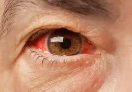 Many people are surprised to find out they have a disease that can cause blindness