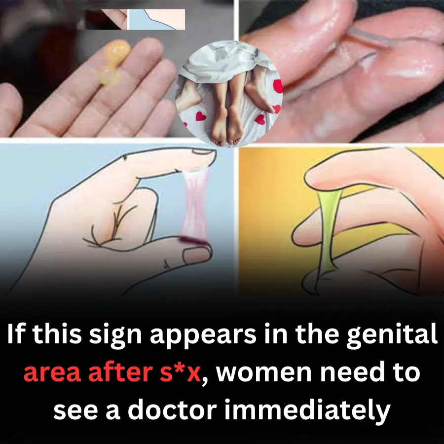If this sign appears in the genital area after s*x, women need to see a doctor immediately