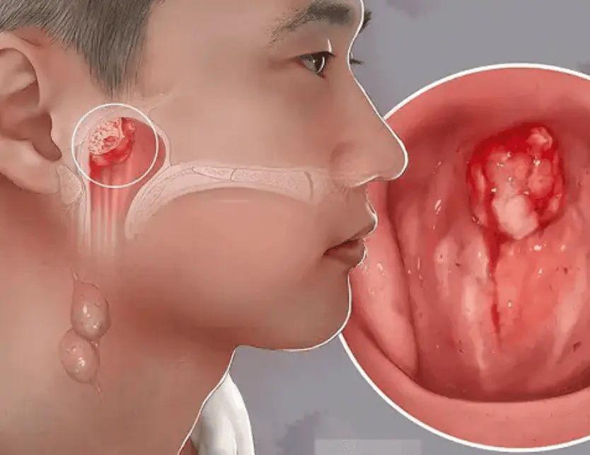 5 nose-related warning signs that may point to underlying di.sea.ses